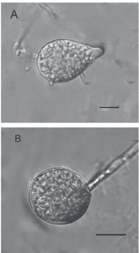 FIGURE 2 - P. nicotianae. A: Terminal papilate sporangia. Bar =  10 µm. B.Terminal spherical chlamidospore