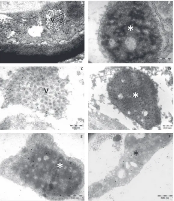FIGURE 4. A.B.  Transmission electron micrograph (TEM) of sections of aldehyde/osmium fixed Spurr  embedded ‘Pera’ sweet orange leaf lesions caused by the infection of CiLV-C