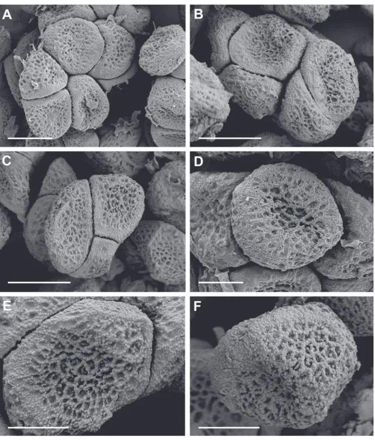 FIGURE 4 -  Teliospores of  Tolyposporium kuwanoanum  as seen by scanning electron microscopy (SH 16)