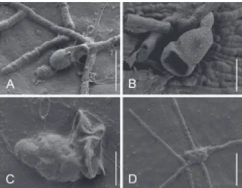 FIGURE  4  -   SEM  photographs  of  Asterolibertia  spp.  from  Panama.  A.   Germinated,  verrucose  ascospore  of   Asterolibertia  licaniicola  on  Licania arborea  (T.A