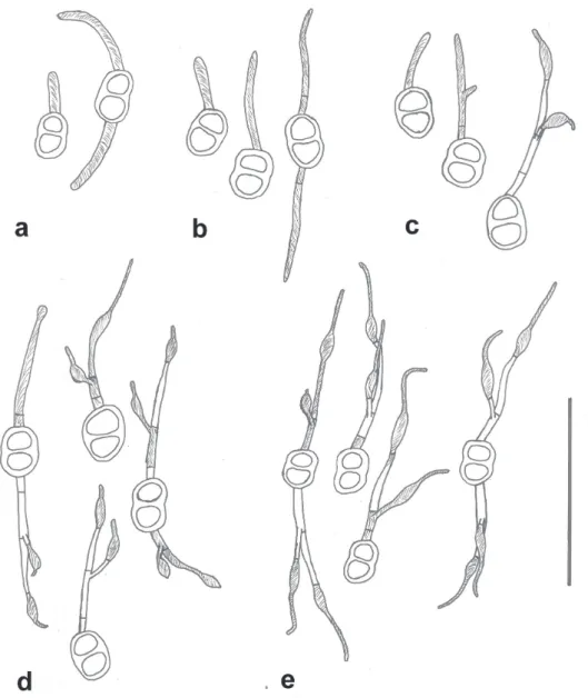 FIGURE  5   -  Camera  lucida  drawings  of  germinating  teliospores  of  Prospodium  transformans  at  different  time  intervals  incubated  at  20°C