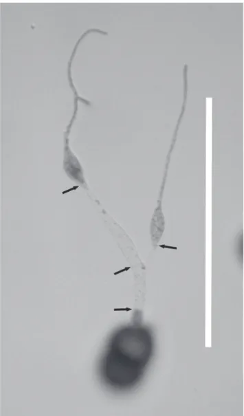 FIGURE 6  - Germinated teliospore of  Prospodium transformans after  incubation  at  20°C  for  24  hours  showing  two  germinated  modified vesicle-like basidiospores, position of septa (arrows) and  concentration of cytoplasm in the basidiospores