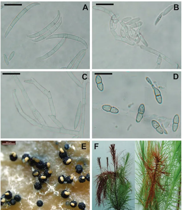 FIGURE  2  -  Morphology of  Fusarium  circinatum  and symptoms.   A . Macroconidia, bar=20 µm;   B 