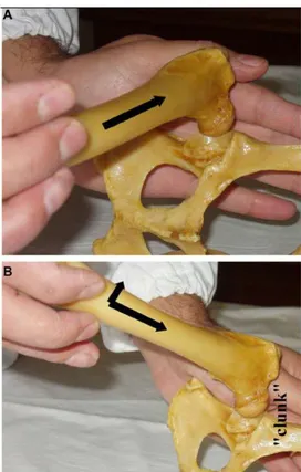 Figure 8: Ortolani test performed with the  dog in lateral recumbency. Reprinted from 