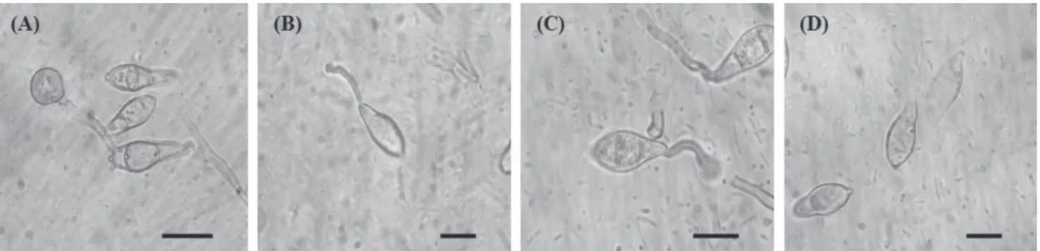 FIGURE  2  - Conidial germination and appressorial formation of  Magnaporthe  oryzae  treated with cerulenin (1.0 µg.mL -1 ) produced  by  Sarocladium  oryzae   under  optical  microscope  (600x)