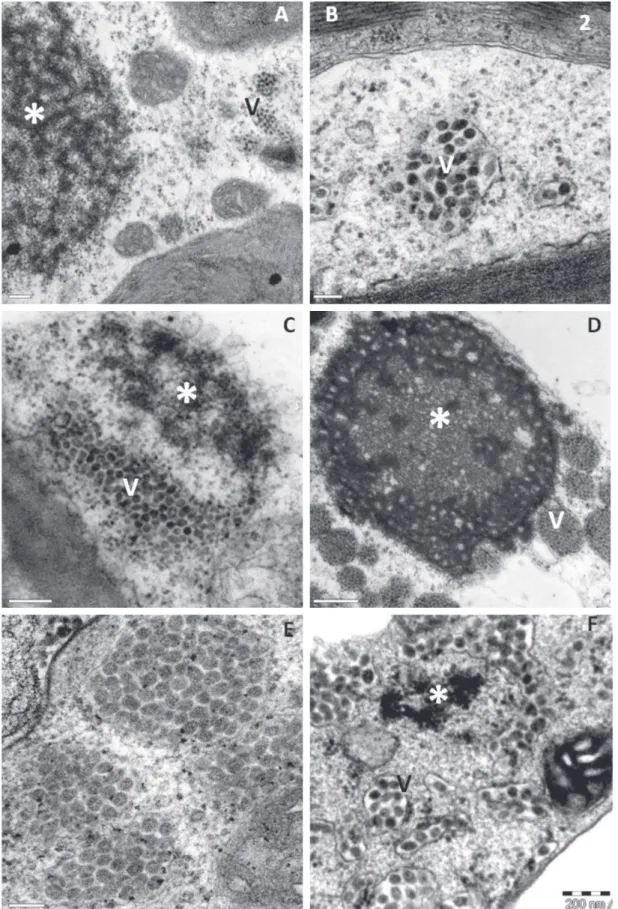 FIGURE 2 -  Transmission electron micrographs of sections from local lesions on leaves of plants experimentally  infected with  Brevipalpus  phoenicis  viruliferous for CiLV-C