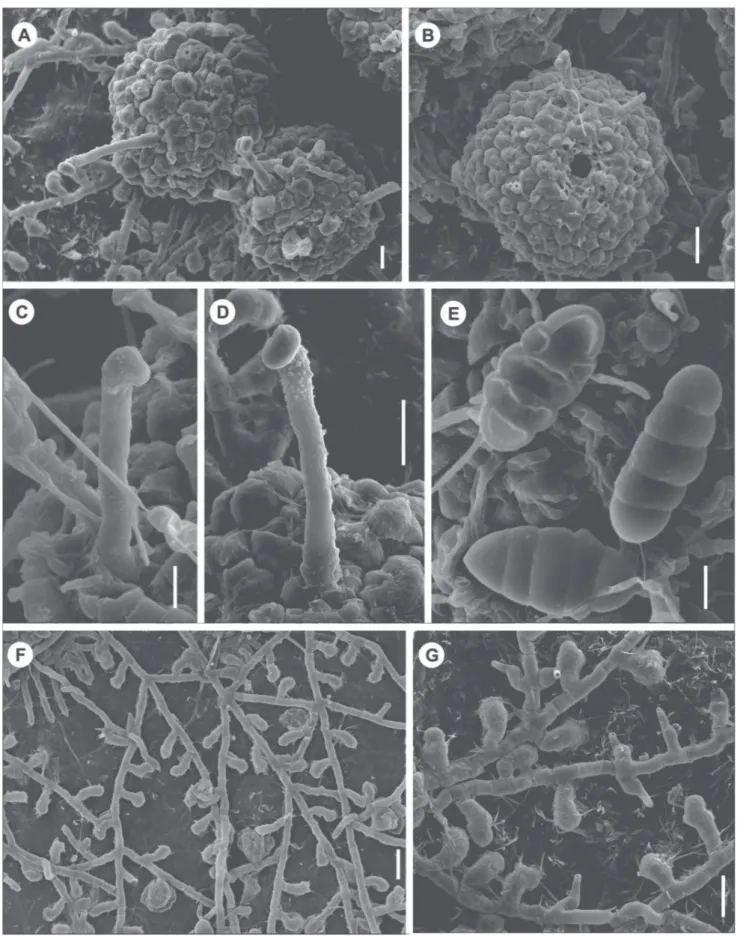 FIGURE 2  - SEM photographs from  Irenopsis vincensii  on  Hevea brasiliensis .  A.  Perithecia (VIC31750)