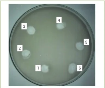 Figure 4. Dot Blot assay showing proteolytic activity of Helicoverpa  armigera gut proteinases (HGP)