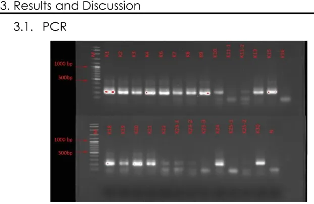 Figure  6  –  Agarose  gel  (1,5%)  electrophoresis  of  PCR  products;  Samples  K1  to  K30;  Molecular  size  marker is marked with the letter M the Negative with the letter N