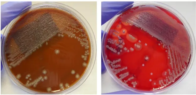 Figura 19: Sementeira em meio PVX com E. coli a  partir da amostra biológica lavado brônquico