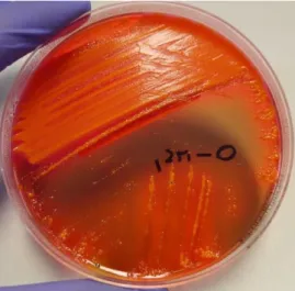 Figura 24: Sementeira em meio HEKT com E. coli a partir de produto biológico fecal. 