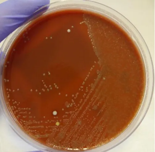 Figura 30: Sementeira em meio PVX com Paenibacillus macerans a partir de uma gotado  produto biológico LCR