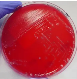 Figura 31: Sementeira em meio NE com Clostridium perfringens e Enterococcus avium a partir do  produto biológico bílis