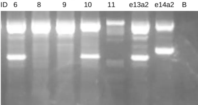 Figura 7 - Electroforese em gel de agarose 2% dos produtos  do PCR-Multiplex. Podemos observar a presença do transcrito  e13a2 nas amostras de sangue total 6 e 10