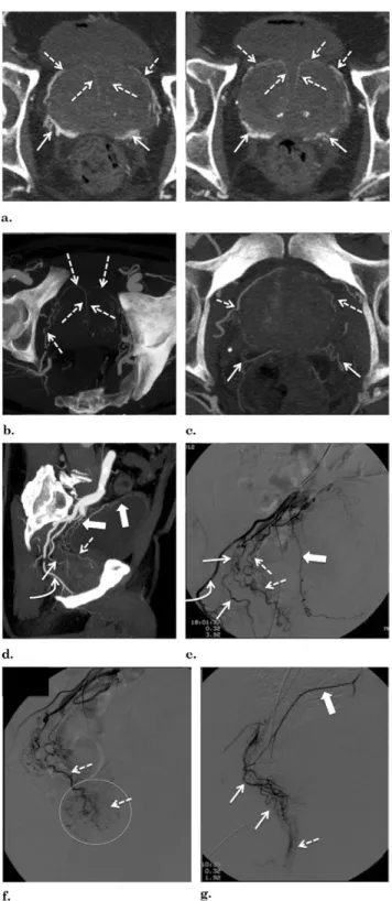 Figure 6. Images from a case with two independent PAs.