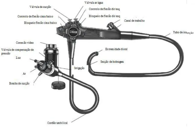 Fig 1. Endoscópio flexível (Chamness, 2011) 