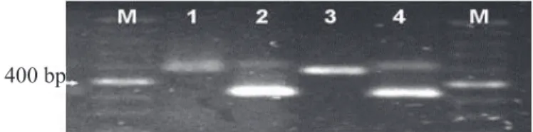 Figure 4.  Eletrophoresis gel of the PCR obtained with the  universal primer of the ItS region (ItS1 e ItS4)  and  the  specific  primer  (P1/P2)  for  the  DNA  of  Stenocarpella  sp