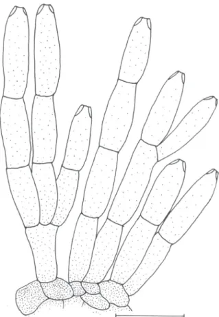 FIGURE  3  -   Seta  and  conidiophores  of  Colletotrichum  hemerocallidis (holotype) on H