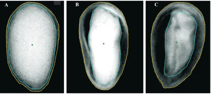 FIGURE  6.  Analysis  of  seed  X-ray  images  (20  kV  /  20  s)  of  cotton  seeds  ‘HCI  5’