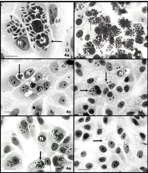FIGURE 4. Morphological aspects of intravacuolar parasites observed under light microscopy (a - f) during treatment of extracts