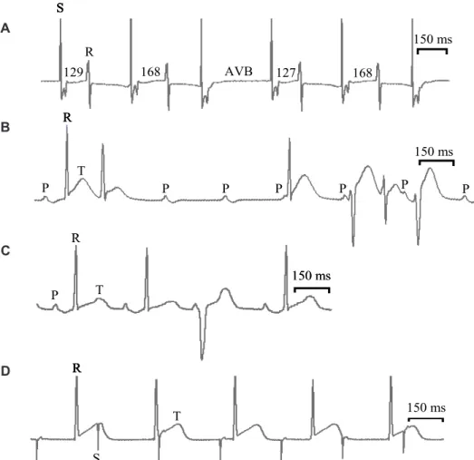 FIGURE 3. Cardiac arrhythmias induced by EGb and its constituents in guinea pig isolated heart