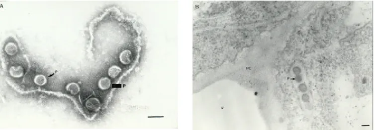 FIG. 3 - Micrografia eletrônica do Tomato chlorotic spot virus (TCSV), isolado de jiló (Solanum gilo)