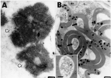 FIG. 2 - Cytopathological alterations caused by Mal de Río Cuarto virus (MRCV) in corn leaf enations.