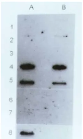 FIG. 4 - Dot blot hybridization with a P 32  cDNA probe from GCLV BR . Samples represented: (1A and 1B) Total RNA extracted from healthy onion (Allium cepa) plants; (2A and 2B) Total RNA extracted from healthy garlic (Allium sativum) plants; (3A and 3B) To