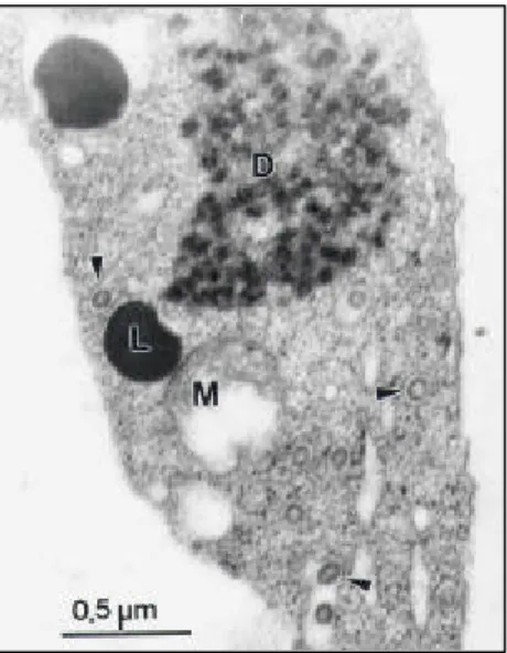 FIG. 2 - Electron micrograph of ultra thin sections of cubiu (Solanum sessiliflorum) leaves infected by Groundnut ringspot virus (GRSV-Cb)
