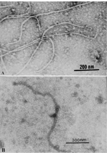 FIG. 3 - Nucleotide sequence of the coat protein gene of Grapevine virus B  (GVB)  BR1