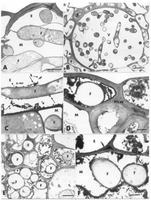 FIG. 4 - Transmission electron micrographs of leaf samples collected from -Si and +Si rice (Oryza sativa) plants 96 h after inoculation with Magnaporthe grisea
