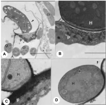 FIG. 3 - Formação de papilas nas células do mesofilo de tomateiro (Lycopersicon esculentum) resistente (Moetelle) e suscetível (Moneymaker) em contato com hifas intercelulares de Stemphylium solani; A - Hifa de S