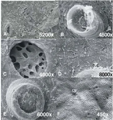 FIG. 1 - Microscopia eletrônica de varredura de folhas de meloeiro (Cucumis melo) com oito dias inoculadas com Acidovorax avenae subsp
