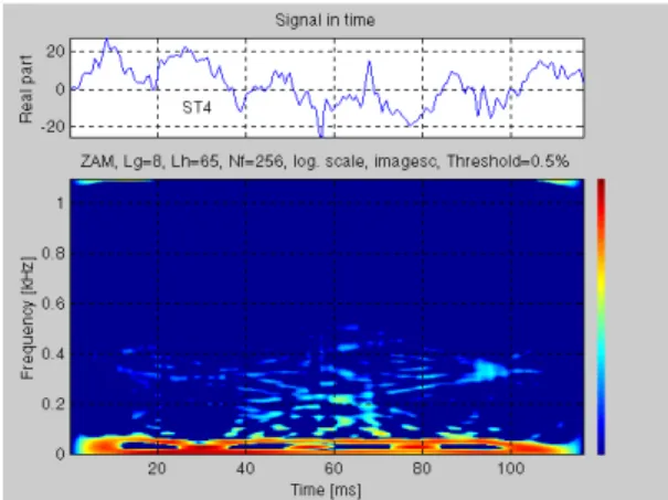Fig. 11: Scalogram for the ST4 segment 