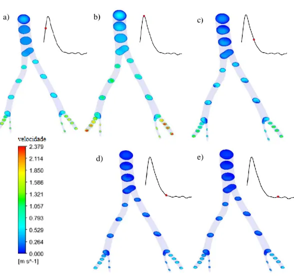 Figura 24 – Distribuição da velocidade na artéria saudável, em regime laminar, em cinco instantes  do ciclo cardíaco: a) 0,0335 s; b) 0,067 s; c) 0,1675 s; d) 0,268 s; e) 0,402 s