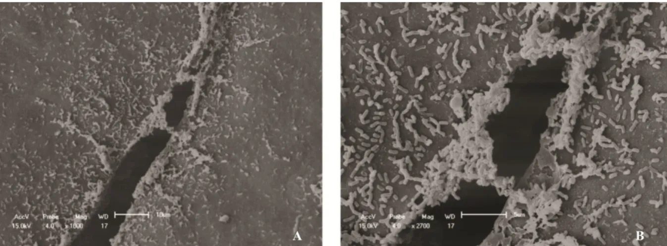 Figure 3. Representative images of the injury caused by the needle puncture inoculation method on the abaxial surface of a leaf of the sweet  orange variety Pera IAC at 3 days after inoculation at (A) 1000× magnification and at (B) 2700× magnification.