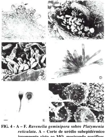 FIG. 4 - A – F. Ravenelia geminipora sobre Platymenia reticulata. A – Corte de urédio subepidérmico irrompente visto ao MO, mostrando paráfises (seta) e urediniósporos equinulados