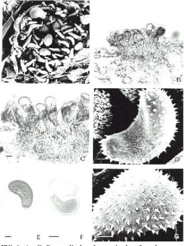 FIG. 7 - A – F. Ravenelia  lonchocarpi sobre Lonchocarpus campestris. A e B – Télios subepidérmicos vistos ao MEV mostrando paráfises periféricas, teliósporos com ornamentos tuberculóides e urediniósporo equinulado
