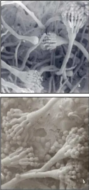 Figure 2 - SEM (a). VB7 sterigmata without differentiation, metulae and phialides prolonged after 32 hours of cultivation (4600 x)