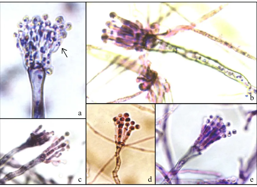 Figure 3 - Giemsa stain. (a). VB7 showing alteration in the nucleus number in phialides caused by the mutation bncA1, growth of 72 hours (1200 x); (b, c, d, e) VB 8 VB9 VB10 and VB11 respectively, sterigmata without differentiation, prolongated metulae and