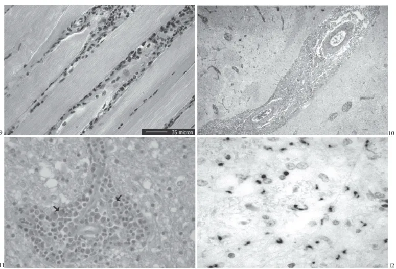 Fig. 12. Numerosos exemplares de Trypanosoma evansi aparecem marcados nos espaços de Virchow-Robin e na neurópila em  cor-tes do encéfalo do Eqüino 18
