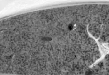 Fig. 3. Fígado com acentuação do padrão lobular, de aspecto de noz- noz-moscada, na intoxicação experimental por Dodonea viscosa em bovinos