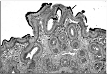 Fig. 1. Intestino grosso de  frango  após  inoculação experimental com Brachyspi ra pi losi coli  presença de um bordo escuro formado pela espiroquetas aderidas ao epitélio intestinal do lúmen  (Seta) e linha marrom escura formada por marcação intracelular
