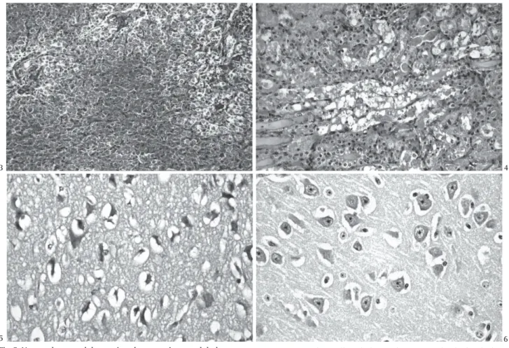 Fig. 3. Necrose hepatocelular maciça e hemorragia centrolobular acen- acen-tuada na intoxicação experimental por Trema micrantha (Bovino 3)