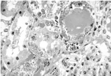 Fig. 2. Intoxicação natural por Amaranthus spinosus em ovinos. Necrose coagulativa de células epiteliais dos túbulos uriníferos (pontas de setas) e cilindros hialinos (setas)