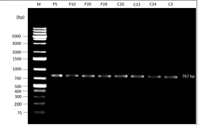 Figure 8 – BIN1 polymorphism region amplified by PCR technique. The product band has 767 bp and was  visualized in 1.5% agarose gel