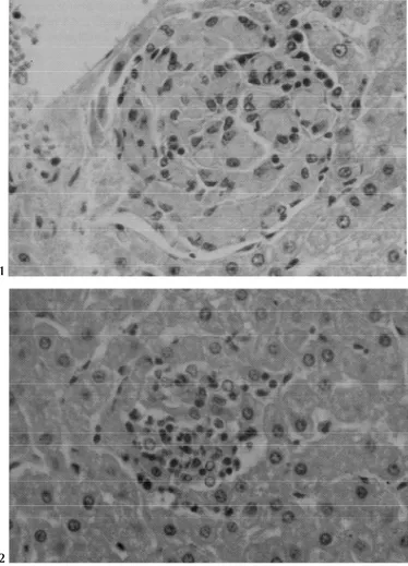 Fig. 1. Fígado com macrófagos de citoplasma espumoso formando um foco próximo a veia centrolobular (Bov