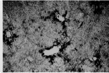 Fig. 2. Monocamadas de células MDBK infectadas com um vírus BVDV  citopático clonadas a partir da amostra IBSP-2, coradas pela técnica de imunoperoxidase