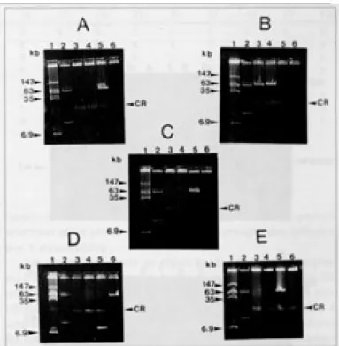 Fig. 1. Perfil plasmidial das 20 cepas (suínas e humanas) de Yersinia enterocolitica, em gel de agarose 0,6%