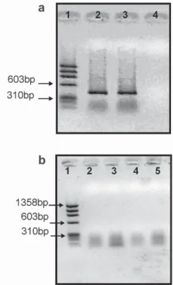 Figure 4 - RT-PCR of cDNA from chicken adipose and liver tissue. (a) β-actin primer. (b) Lep_3 primer, 1:
